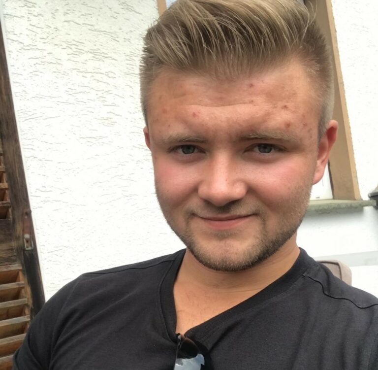 Ein Mann mit blondem Haar und einem schwarzen T-Shirt lächelt in die Kamera. Er hat einige Pickel auf seinem Gesicht.