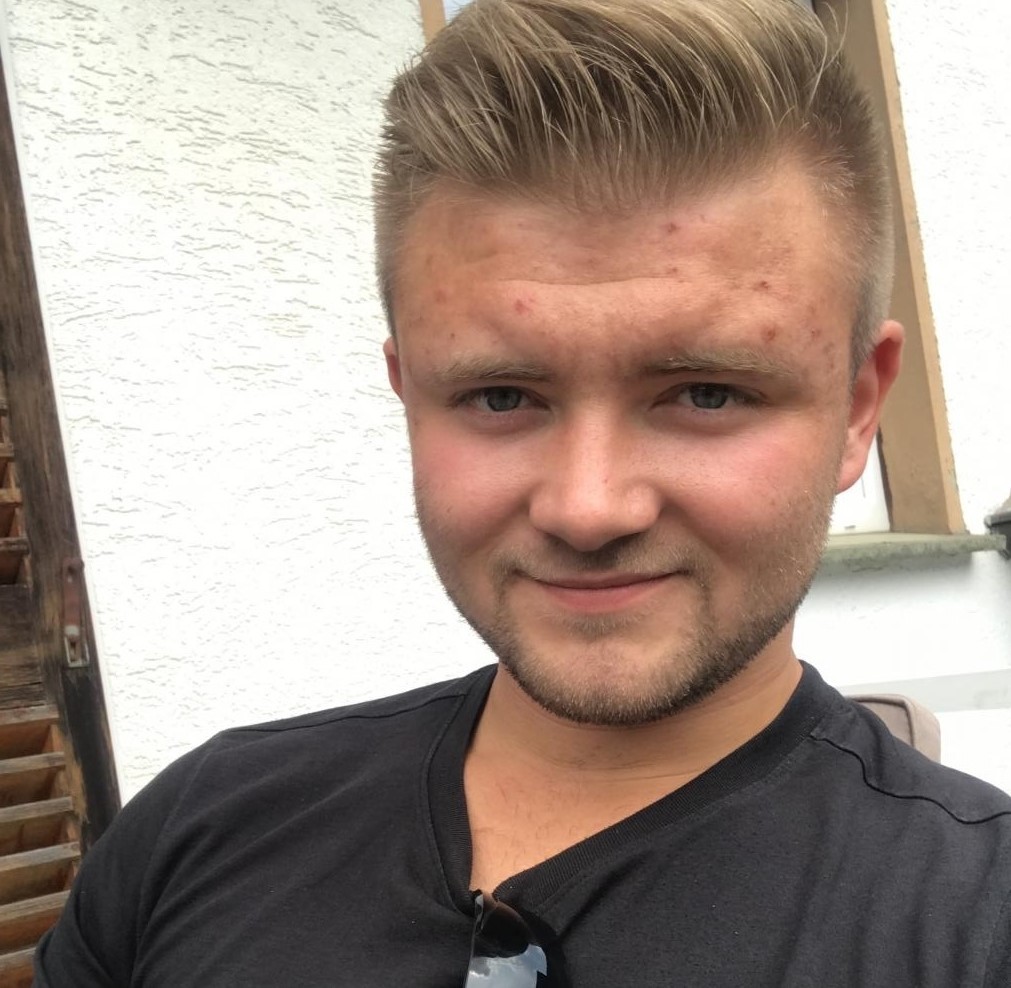 Ein Mann mit blondem Haar und einem schwarzen T-Shirt lächelt in die Kamera. Er hat einige Pickel auf seinem Gesicht.